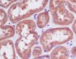 Anti-PDPK1/Pdk 1 Rabbit Monoclonal Antibody